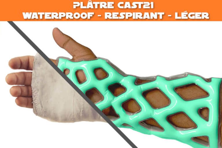 Plâtre Cast21 le plâtre en résine waterproof, respirant et léger